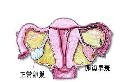 在性交时出现疼痛,从而导致性欲下降,也考虑为卵巢早衰的可能