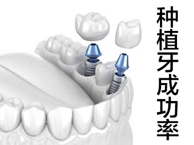 法国安卓健种植系统特点天津法国anthgoyr全口种植牙去哪里好